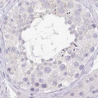Immunohistochemical staining of human testis using Anti-PRR27 antibody HPA036150.