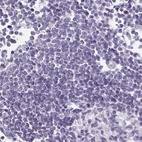 Immunohistochemical staining of human lymph node using Anti-PRR27 antibody HPA036150.