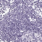Immunohistochemical staining of human lymph node using Anti-PRR27 antibody HPA036150.