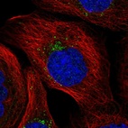 Immunofluorescent staining of human cell line A-431 shows localization to vesicles.