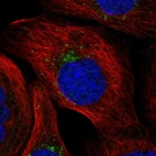 Immunofluorescent staining of human cell line A-431 shows localization to vesicles.