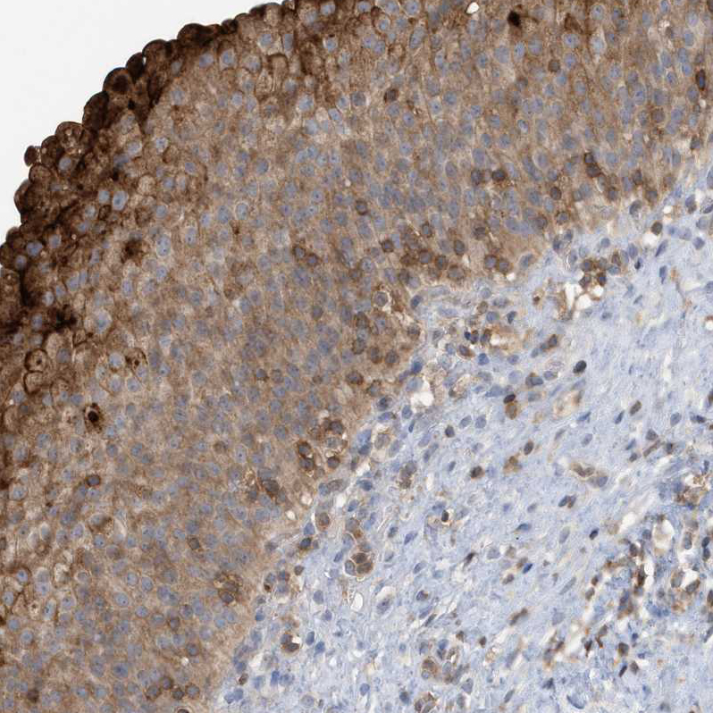 Anti-NSUN3 Antibody