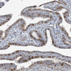 Anti-CDS1 Antibody