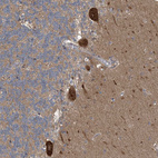 Immunohistochemical staining of human cerebellum shows moderate cytoplasmic positivity in purkinje cells.
