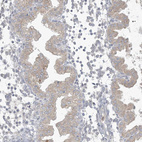 Immunohistochemical staining of human endometrium shows weak cytoplasmic positivity in glandular cells.