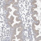 Immunohistochemical staining of human endometrium shows weak cytoplasmic positivity in glandular cells.