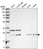 Western blot analysis in human cell line RT-4, human cell line U-251 MG, human plasma, human liver tissue and human tonsil tissue.