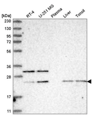 Western blot analysis in human cell line RT-4, human cell line U-251 MG, human plasma, human liver tissue and human tonsil tissue.