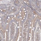 Immunohistochemical staining of human duodenum shows moderate cytoplasmic positivity in glandular cells.