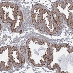 Immunohistochemical staining of human endometrium shows strong cytoplasmic granular positivity in glandular cells.