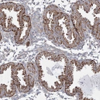 Immunohistochemical staining of human endometrium shows strong cytoplasmic granular positivity in glandular cells.