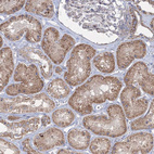 Immunohistochemical staining of human kidney shows moderate cytoplasmic granular positivity in cells in tubules.