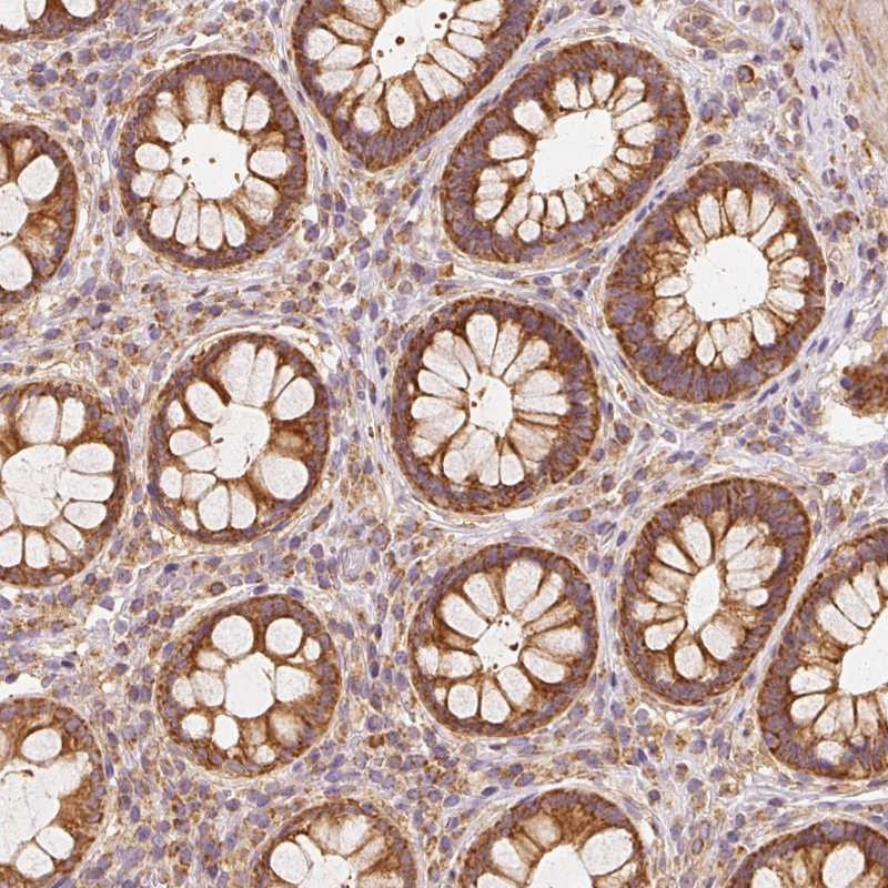 Anti-TOMM40 Antibody
