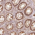 Anti-TOMM40 Antibody
