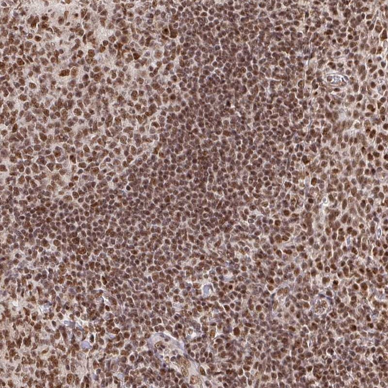 Anti-USF1 Antibody