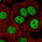 Immunofluorescent staining of human cell line MCF7 shows localization to nucleoplasm.