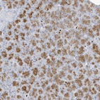 Anti-FAM98A Antibody