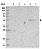 Lane 1: Marker [kDa] 230, 130, 95, 72, 56, 36, 28, 17, 11_br/_Lane 2: Human cell line RT-4_br/_Lane 3: Human cell line U-251MG sp_br/_Lane 4: Human plasma (IgG/HSA depleted)_br/_Lane 5: Human liver tissue_br/_Lane 6: Human tonsil tissue
