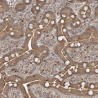 Immunohistochemical staining of human Duodenum shows moderate granular cytoplasmic positivity in glandular cells.
