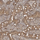 Immunohistochemical staining of human Duodenum shows moderate granular cytoplasmic positivity in glandular cells.
