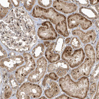 Immunohistochemical staining of human Kidney shows moderate granular cytoplasmic positivity in cells in tubules.