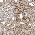 Immunohistochemical staining of human Kidney shows moderate granular cytoplasmic positivity in cells in tubules.