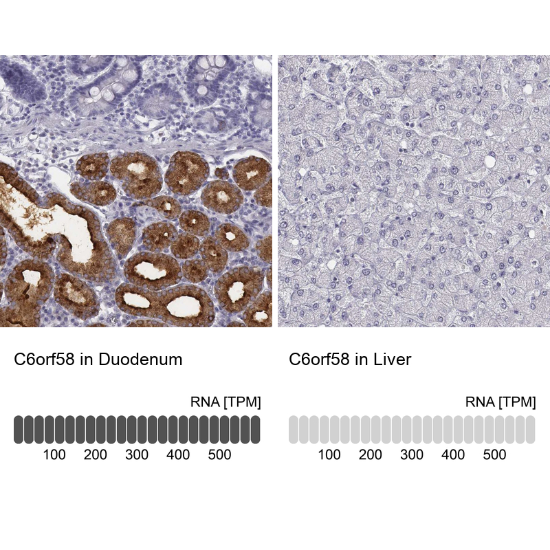 Anti-C6orf58 Antibody