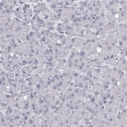 Immunohistochemical staining of human liver shows low expression as expected.