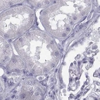 Immunohistochemical staining of human kidney using Anti-C6orf58 antibody HPA036263.