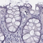 Immunohistochemical staining of human colon using Anti-C6orf58 antibody HPA036263.