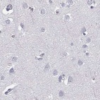 Anti-C6orf58 Antibody