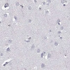 Immunohistochemical staining of human cerebral cortex using Anti-C6orf58 antibody HPA036263.