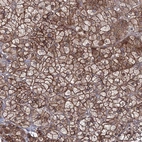 Anti-EXOC6 Antibody