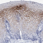 Immunohistochemical staining of human esophagus shows high expression.