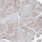 Immunohistochemical staining of human skeletal muscle shows no positivity in myocytes as expected.