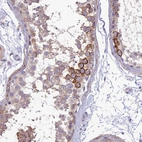 Immunohistochemical staining of human testis shows moderate to strong membranous positivity in cells in seminiferous ducts.