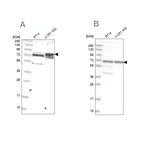 Western blot analysis using Anti-GNL3L antibody HPA036315 (A) shows similar pattern to independent antibody HPA036314 (B).
