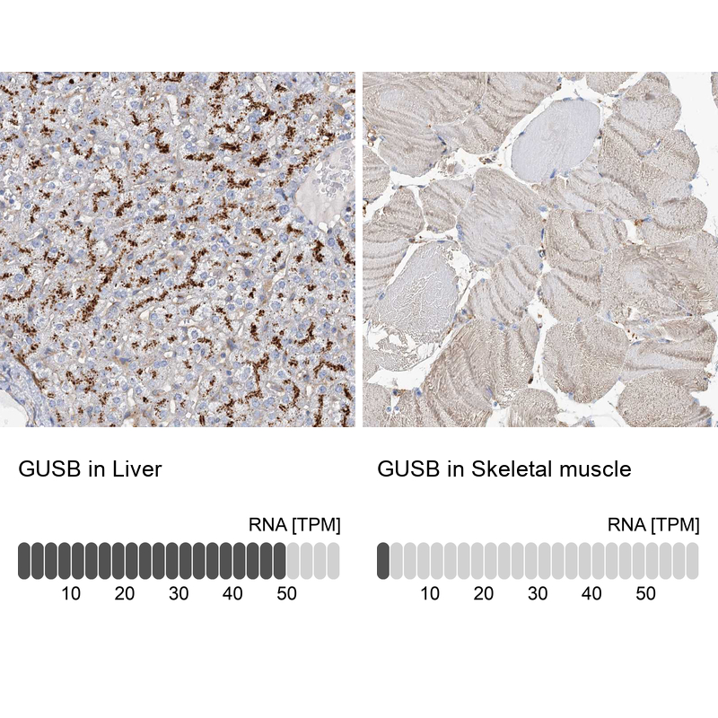 Anti-GUSB Antibody