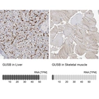 Anti-GUSB Antibody