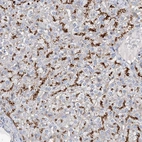 Immunohistochemical staining of human Liver shows strong positivity in lysosomes in hepatocytes.