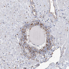 Immunohistochemical staining of human Prostate shows strong positivity in lysosomes in glandular cells.