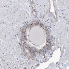 Immunohistochemical staining of human Prostate shows strong positivity in lysosomes in glandular cells.