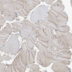 Immunohistochemical staining of human Skeletal muscle shows very weak positivity in myocytes.