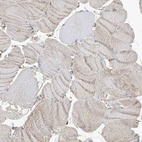 Immunohistochemical staining of human Skeletal muscle shows very weak positivity in myocytes.
