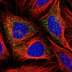 Immunofluorescent staining of human cell line U-2 OS shows localization to vesicles.