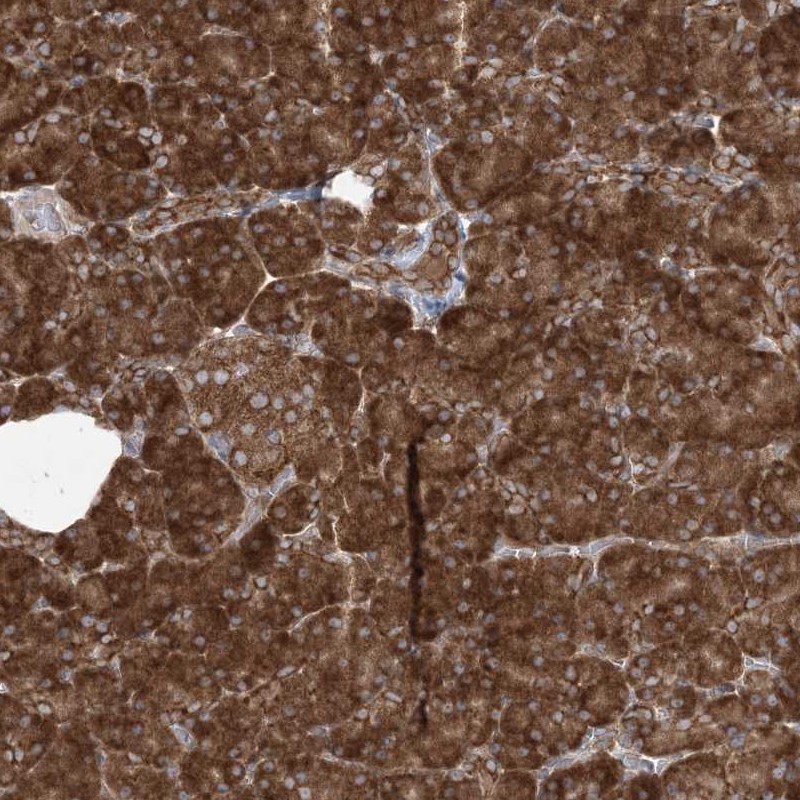 Anti-UBXN4 Antibody