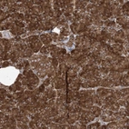 Anti-UBXN4 Antibody