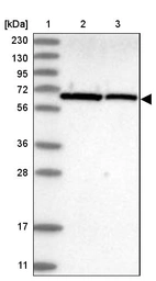 Lane 1: Marker [kDa] 230, 130, 95, 72, 56, 36, 28, 17, 11_br/_Lane 2: Human cell line RT-4_br/_Lane 3: Human cell line U-251MG sp