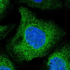 Immunofluorescent staining of human cell line A-431 shows localization to endoplasmic reticulum.