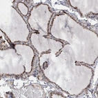 Anti-ANAPC1 Antibody